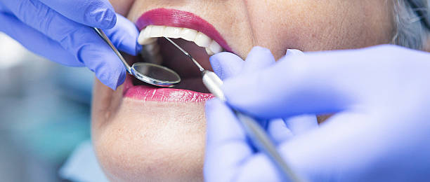 Best Emergency Gum Treatment in Manchaca, TX